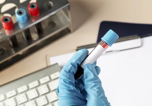 Advanced Semen Analysis​